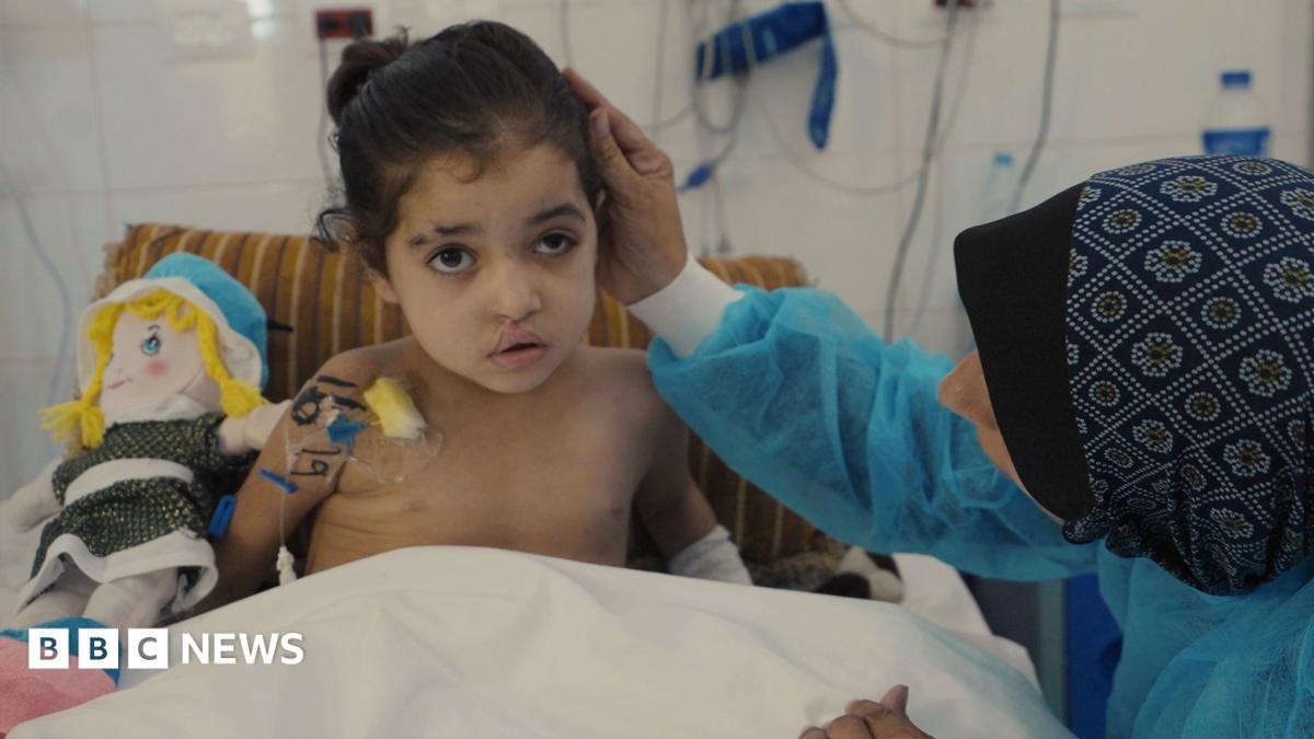 Girl Endures Multiple Surgeries After Gaza Helicopter Strike