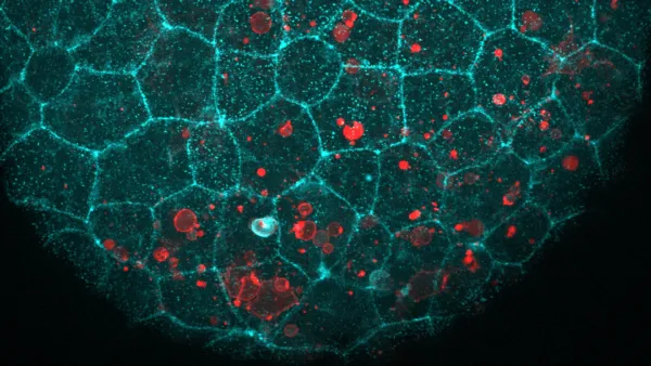 E‑cadherin’s Surprising Second Job: Clearing Dead Cells