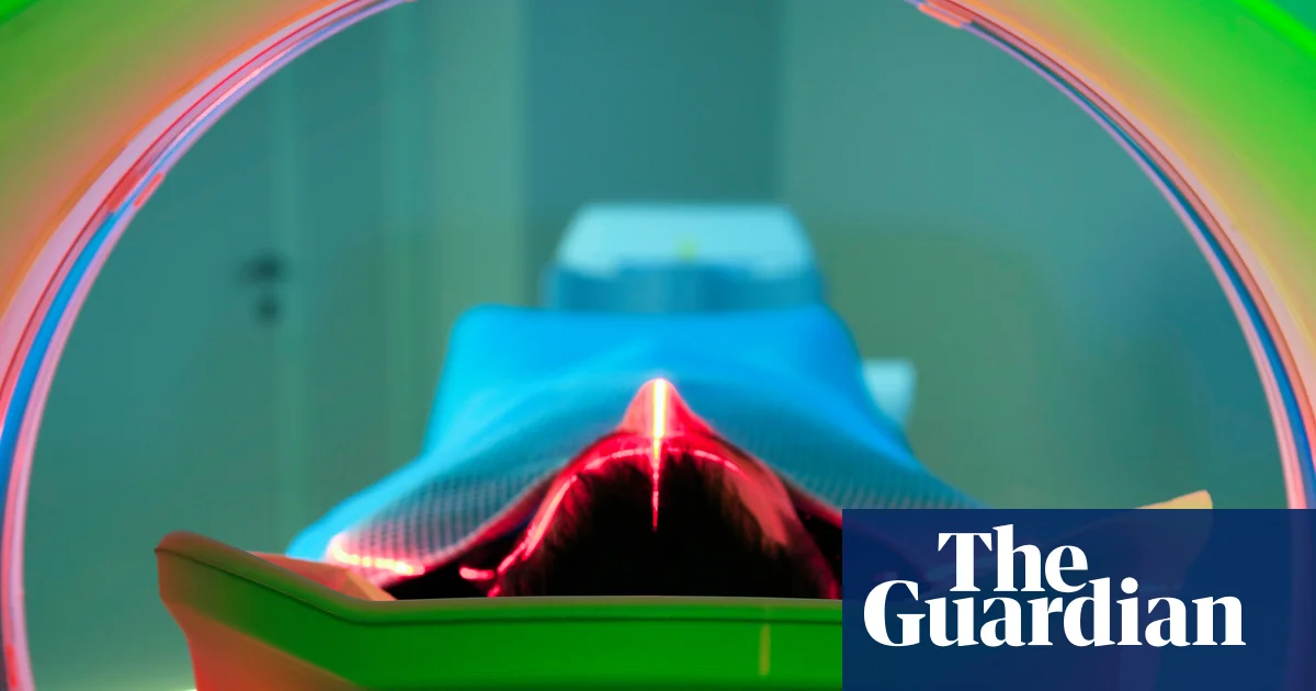 Young Adults Face Sharp Rise in Cancer Diagnoses, Study Shows