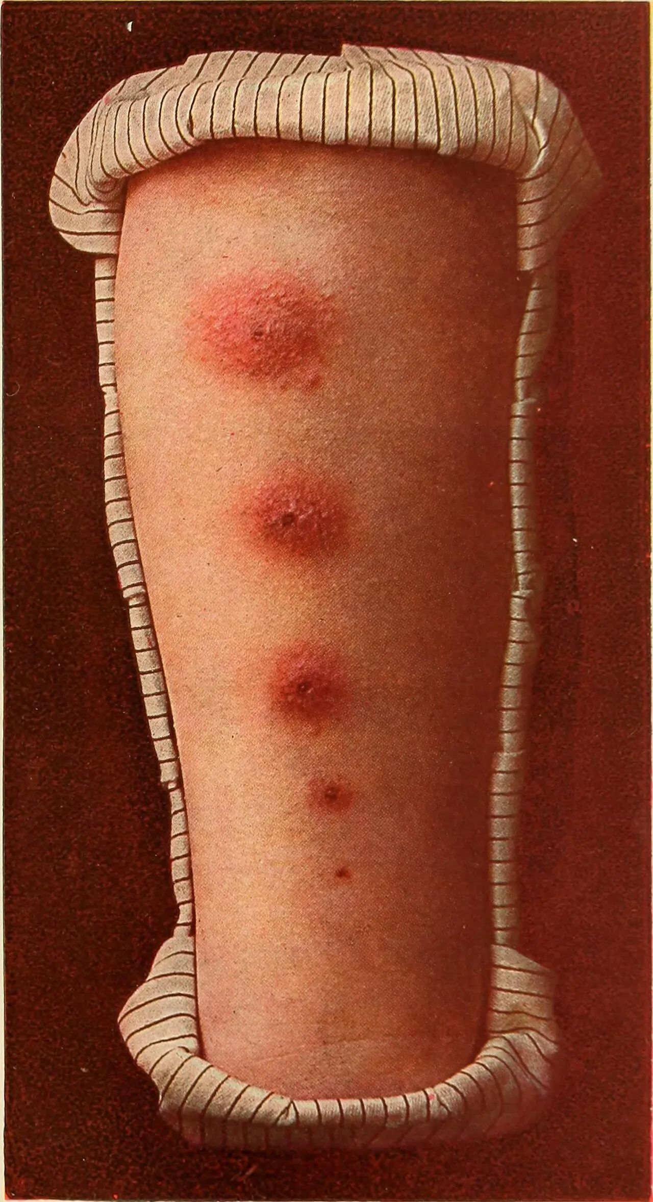 Cover image for Trump's Vaccine Overhaul Plan